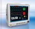 Máy theo dõi bệnh nhân đo NIBP với chức năng quản lý thông tin bệnh nhân